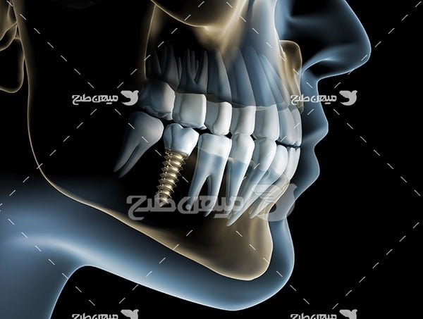 عکس تبلیغاتی پزشکی و رادیولوژی فک