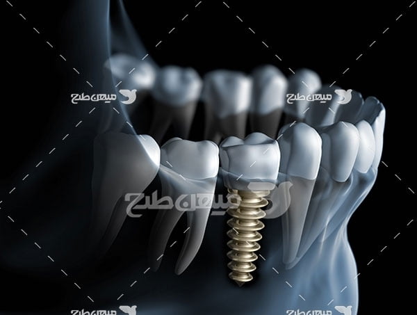 عکس تبلیغاتی پزشکی و عکسبرداری از فک