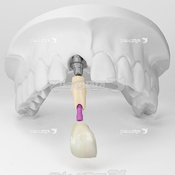 عکس دندان مصنوعی