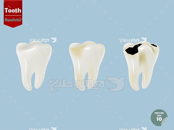 وکتور دندان آسیب دیده