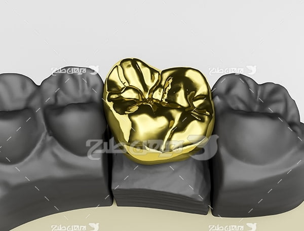 عکس دندان مصنوعی
