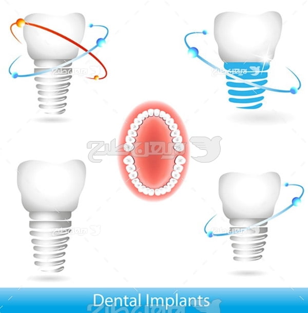 وکتور دندان مصنوعی