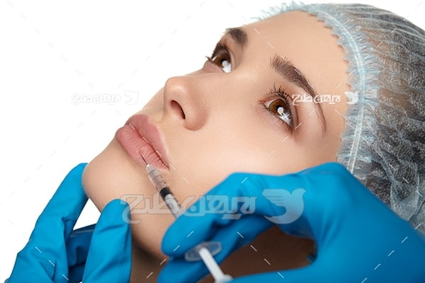 عکس تزریق ژل لب