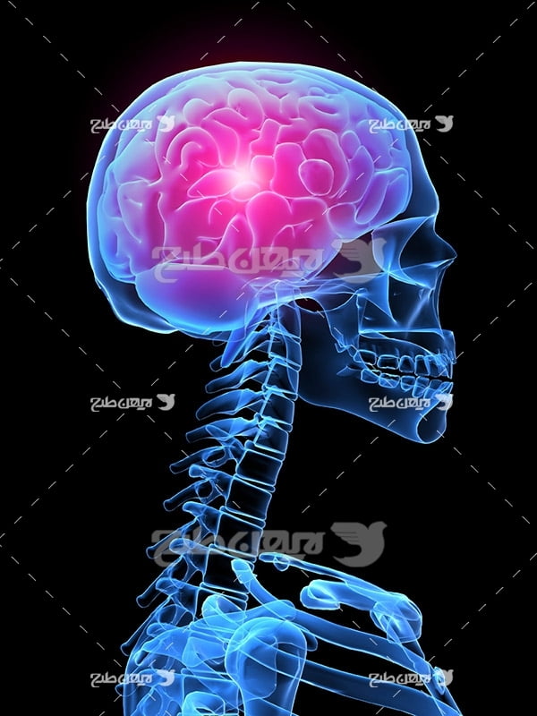 عکس از مغز