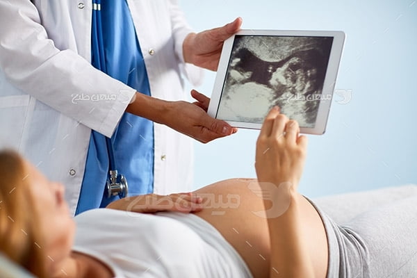 عکس حاملگی