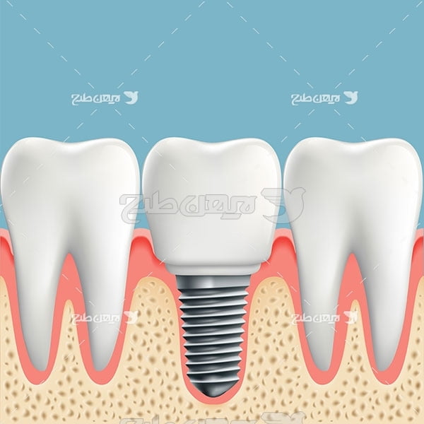 وکتور گرافیکی دندان