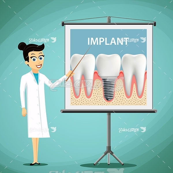 وکتور گرافیکی دندان و ایمپلنت