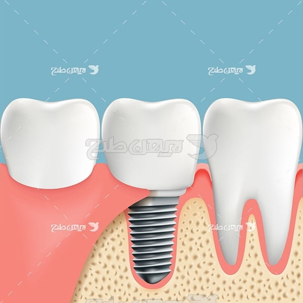 وکتور گرافیکی دندان