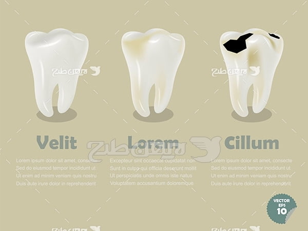 وکتور دندان آسیب دیده