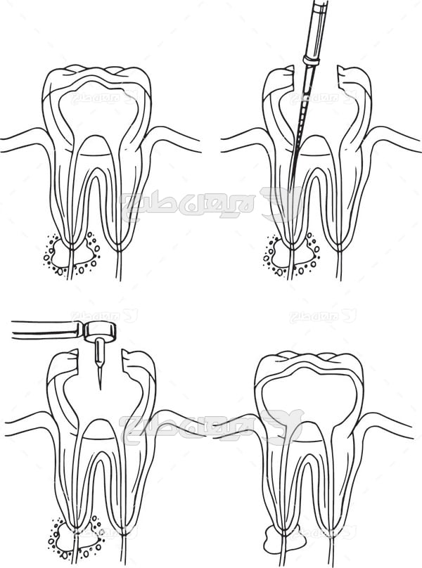 وکتور گرافیکی درمان دندان