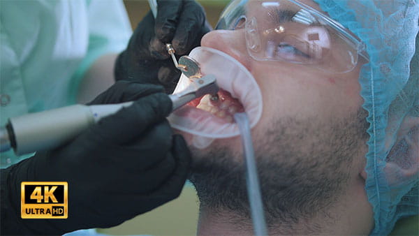 ﻿فوتیج ویدیویی دندانپزشکی